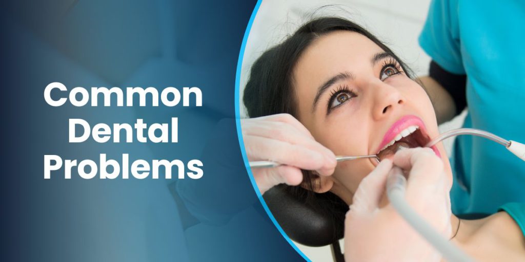 What are 3 common dental problems?