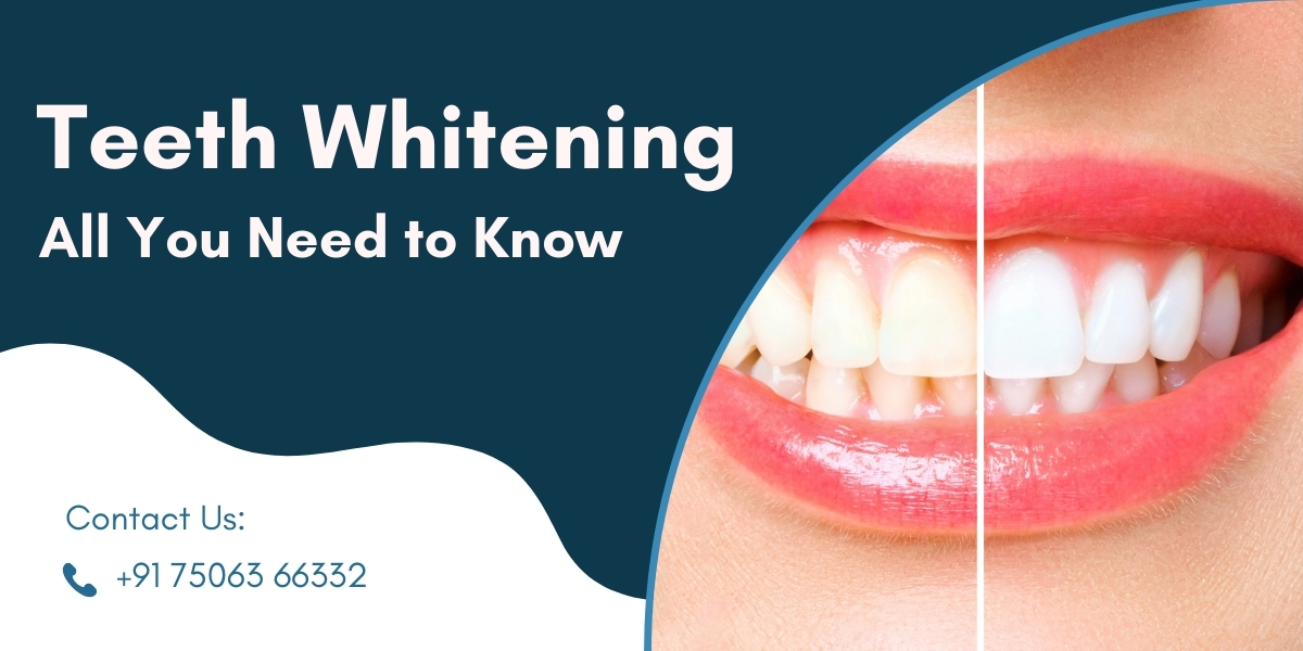 Teeth Whitening : All you need to know