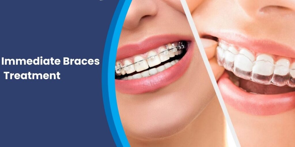 Dental conditions that require immediate braces treatment