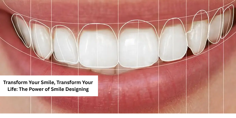 Transform Your Smile, Transform Your Life: The Power of Smile Designing